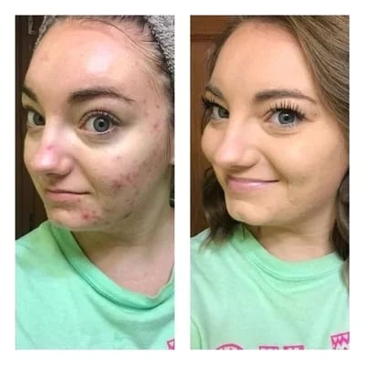 🎁Tricolor concealer